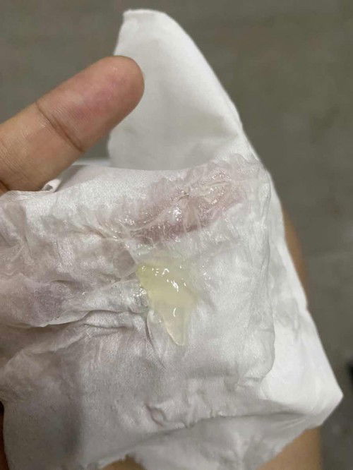 อาการเเบบนี้คืออะไีรคะ??