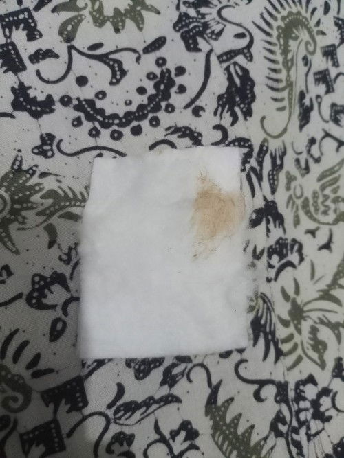 Bunda pernah ngeflek beginikah saat usia 5w? Apa yang bunda lakukan?