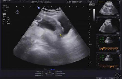 รบกวนแม่ๆช่วยดูเพศช่วยหน่อยจ้า