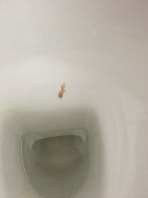 อาการแบบนี้คืออะไร