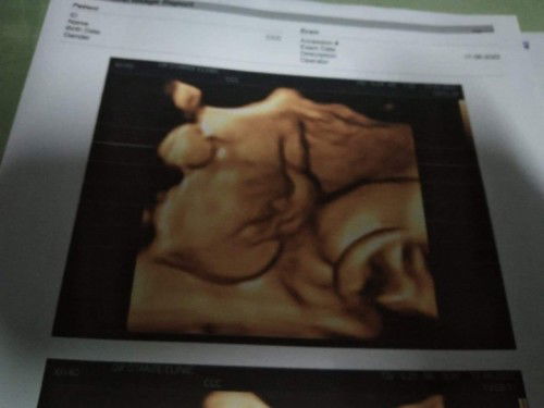 ทีมสิงหาคม