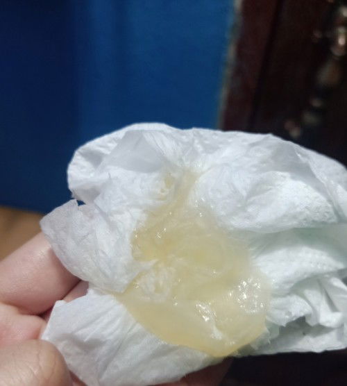 สอบถามเเม่ๆหน่อยคะ ท้อง38+3 วีคมีวุ้นใสๆเเบบนี้ออกมาคืออะไรคะ ไม่มีกลิ่น เเร้วก้อมีมูสเหมือนตกขาว