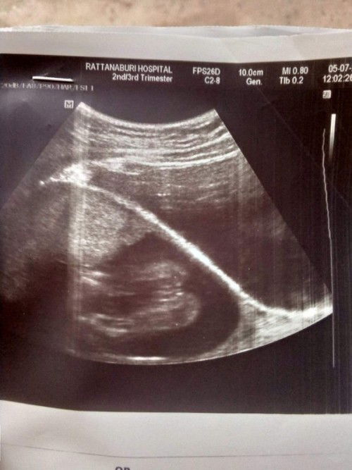 สอบถามแม่ๆหน่อยค้ะน้องคือเพศอะไรค้ะ