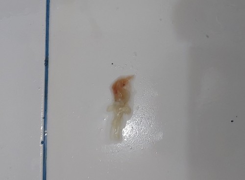 Mucus plug?