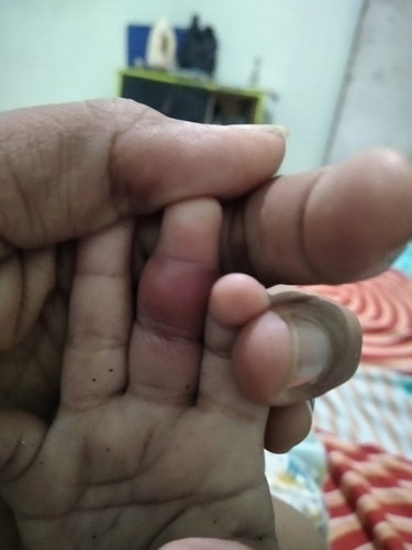 Ini ada yg tau misal cari tau penyakitnya ke dokter apa ya soalnya udah ke bidan sama tkng urut