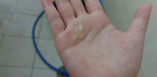 39 week +1 ไม่เจ็บท้องเตือนไม่มีอาการอะไร แต่วันนี้มีมูกใสออกมา ปกติไม่มี