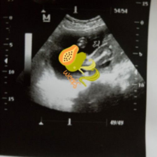 Ano gender ni baby mga mamsh. Hulaan nyo 🥰