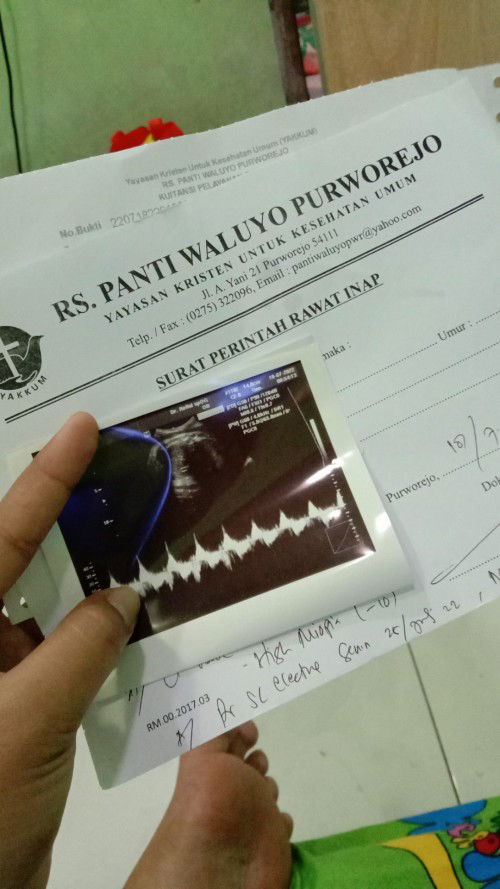 Mohon doanya ya bunda bunda semua 🥰