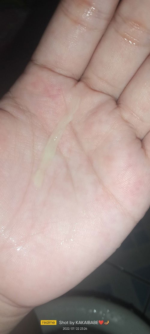 Pahelp namn Po ano kaya tong discharge NATO?