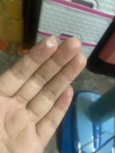 38สัปดา มีเหมือนตกขาวข้นแต่ไม่เป็นมูกมีอาการท้องเเข็งบ่อย