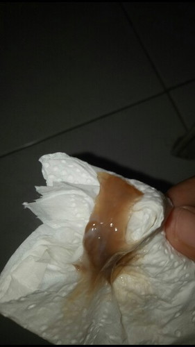 DISCHARGE AFTER SEX