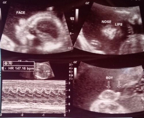 Hello po, I just want to share my 21 weeks baby🥰🥰🥰