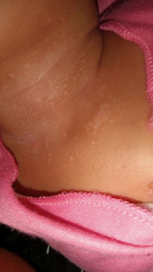 Ketumpahan Bekas ASI