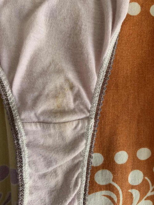 Dark yellow spotting in 6 week of pregnancy