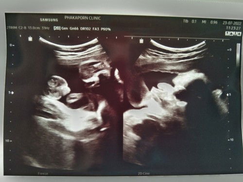 รู้เพศแล้ว😘