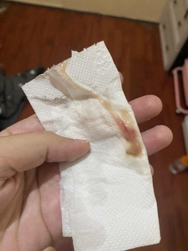 mucus plug