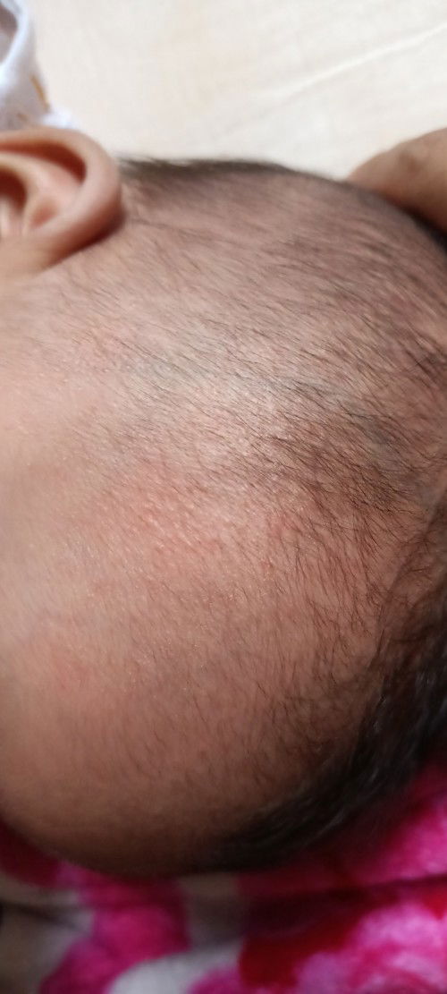 Anak 3 bulan 20 hari