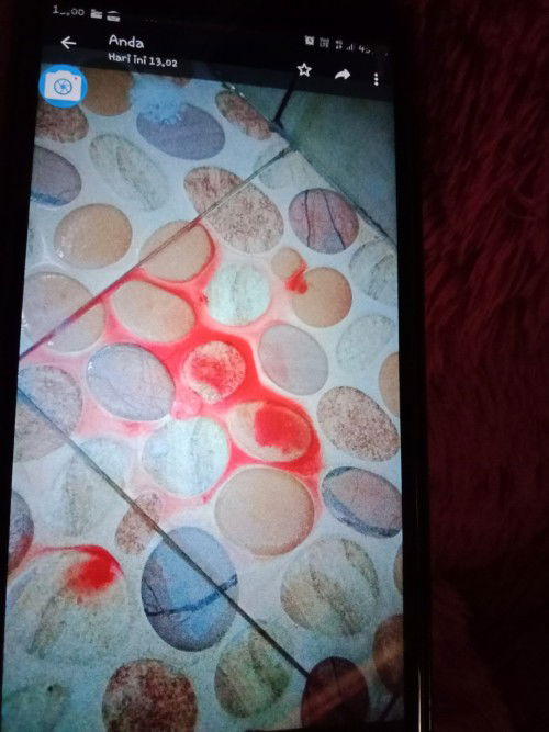 Keluar darah di uk 35 minggu 2 hari