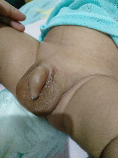 Titit mengeluarkan putih2