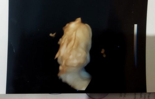 USG 4D jenis kelamin masih belum tau yang penting sehat sempurna. aamiin