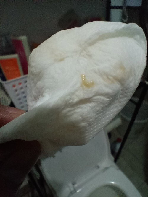 Ano kaya to mga mamsh? Please help