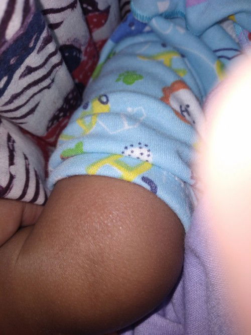 Ibu menyusui tapi tangan kena ekxsim