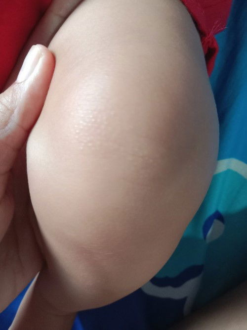 Mungkin kah sejenis alergi