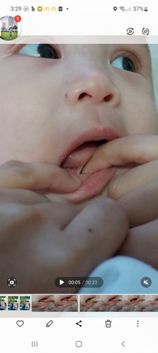 Ka asian parents, ask ko lang tongue Tie po ba ito?may idea po ba kayo kung magkano patanggal nito?