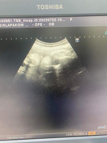 ฝากพิเศษ vs ฝากธรรมดา