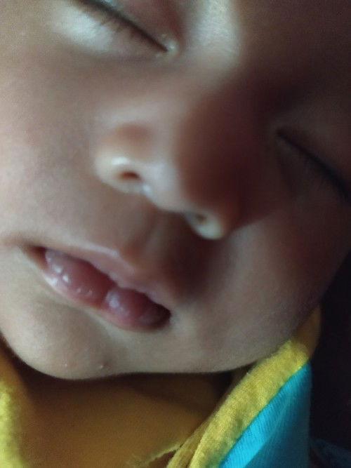 Bibir bayi 2 bulan 4 hari kering