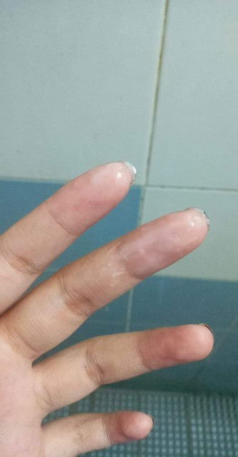 น้ำแบบนี้ปกติไหม?