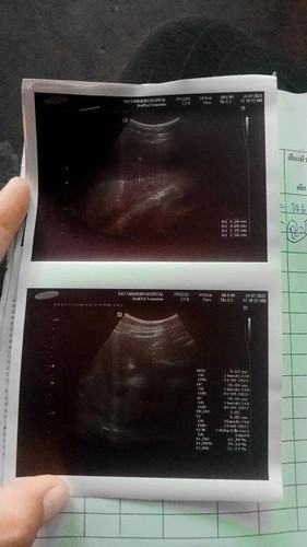 น้ำหนักลูก