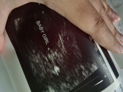 4months ultrasound result