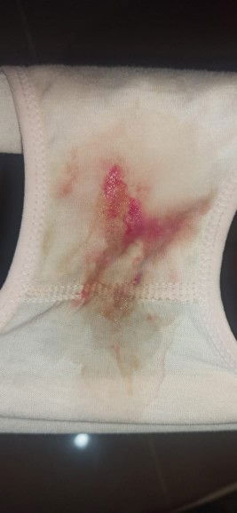 Setelah berkali kali KONPAL