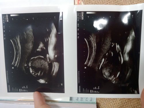 ผู้หญิงหรือผู้ชาย