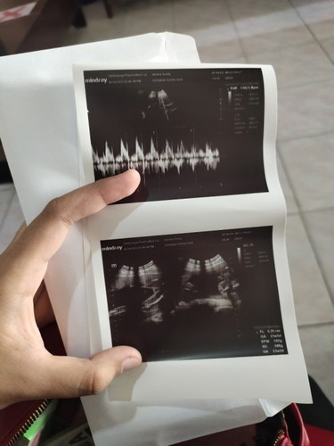October 16 due date π