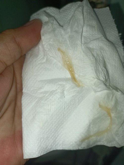 Mucus plug?