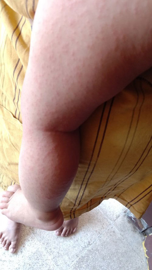 Ini penyakit apa ya Bun