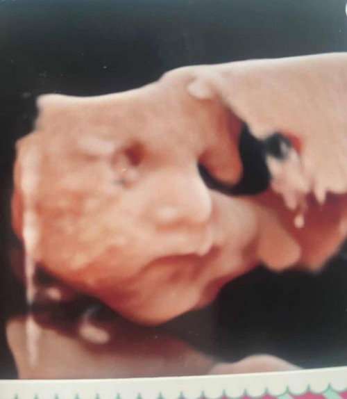 Ada tips tak untuk baby turun ke bawah? 
Tadi scan 5D baby sonsang…