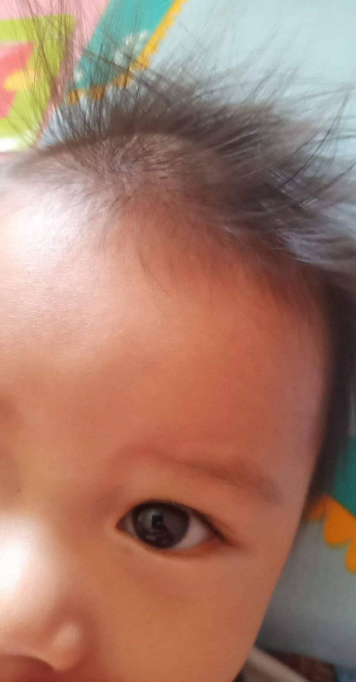 Maumbok na bumbunan ni baby