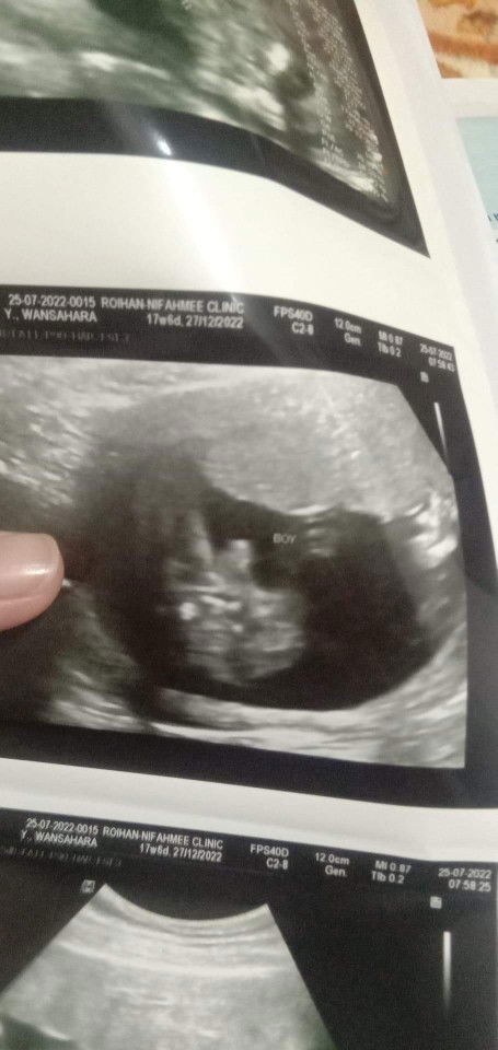 ชัวร์ไหมค่ะ