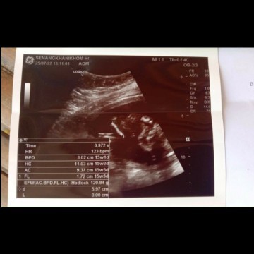 น้ำหนักน้อง14+6วีค ???