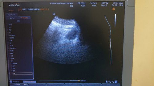 Scan Nampak Kantung je