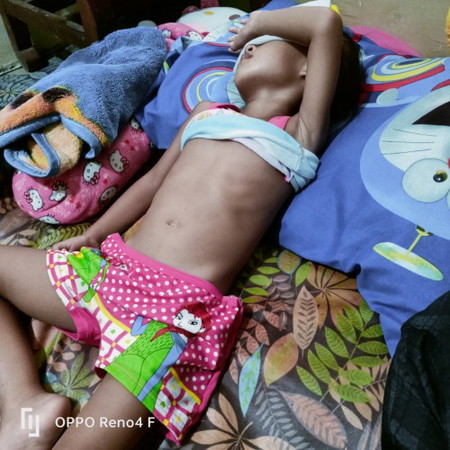 Solusinya bun...anak saya lagi sakit sariawan sudah 4 hari gak mau makan dan minum.sudah periksa jg