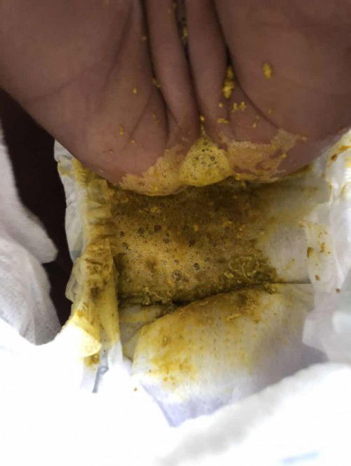 Baby saya baru berusia 45hari