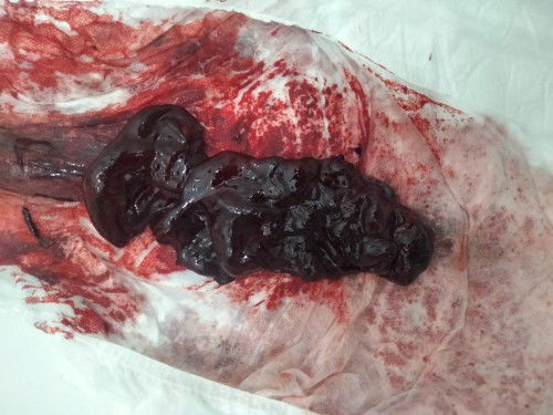 5 months preggy pero palagi dinudugo