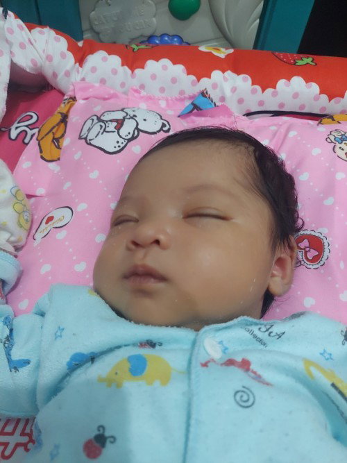 Warna kulit tidak rata/tanda lahir