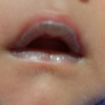 Bibir bayi