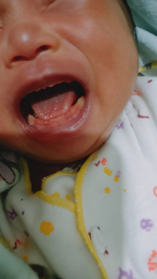 Gusi bayi baru lahir