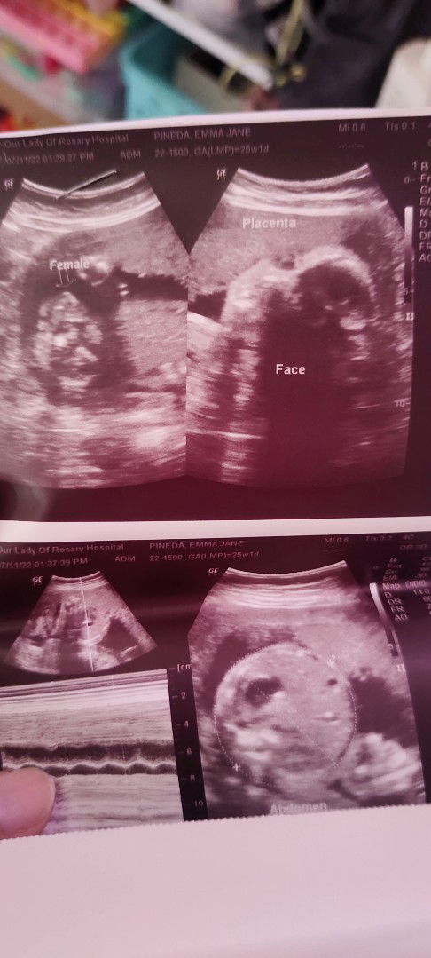 Girl na po ba talaga